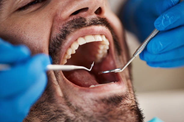 Best Emergency Orthodontic Repairs in East Douglas, MA
