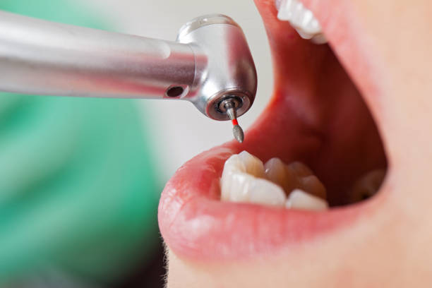 Best Emergency Treatment for Toothache in East Douglas, MA